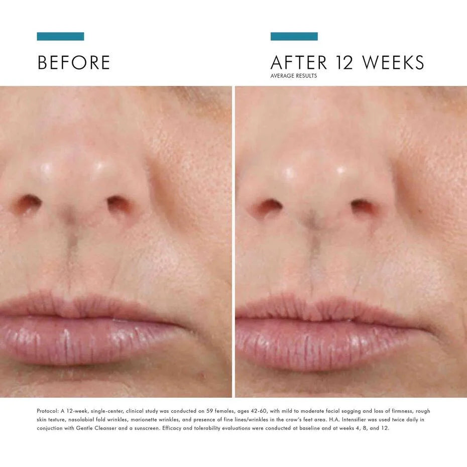 Skinceuticals Hyaluronic Acid Intensifier
